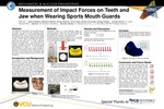 Measurement of Impact Forces on Teeth and Jaw when Wearing Sports Mouth Guards by Alghamdi Abdullah, Alnaser Mobarak, Quiroz Ingrid, Serrate Ciro Alcoba, and Veizaga Rodrigo