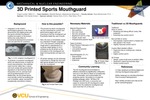 3D Printed Sports Mouthguard