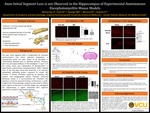 Axon Initial Segment Loss is not Observed in the Hippocampus of a Experimental  Autoimmune Encephalomyelitis Mouse Model